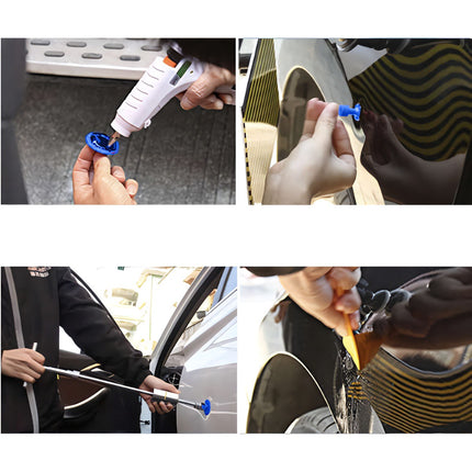 Body dent removal kit